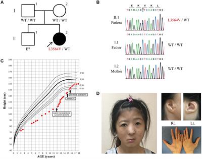 Individual Clinically Diagnosed with CHARGE Syndrome but with a Mutation in KMT2D, a Gene Associated with Kabuki Syndrome: A Case Report